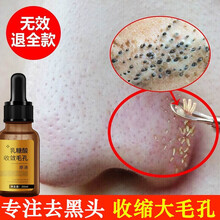 【修复大毛孔】收缩毛孔精华液去黑头乳糖酸原液修复毛孔粗大细致毛孔 萃然美 1瓶装【30ml】