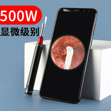 木丁丁 掏耳朵神器可视挖耳勺500w像素高清智能无线内窥镜电动耳屎清洁器专业发光采耳工具套装儿童成人 500W像素智能可视耳勺【黑色】+PPC耳勺*8