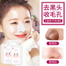 淑魅儿去黑头鼻贴面膜【祛黑头鼻贴男女士螨虫导出液 清洁去粉刺收缩毛孔 撕拉式-10-20片装】 去黑头鼻贴疗程40片装