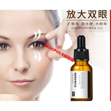 上眼皮松弛下垂修护提拉紧致嫩肤去脂肪厚肿眼泡浮肿眼部精华油两瓶装