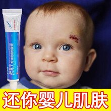 疤痕一抹消去疤痕倍舒痕膏去疤痕修复无痕美过疤克腿部 新客试用【淡疤无痕】