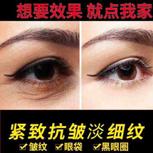 蛇毒眼膜眼袋贴眼贴膜烟酰胺去黑眼圈眼袋细皱纹眼袋消紧致抗皱眼纹消淡化皱纹保湿补水舒缓男女可用慕漾 深层修护两瓶装(大容量120片)99%的用户选择