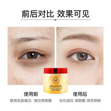 st眼膜官方紧致媚眼明眸果纤抗皱眼膜贴眼i霜去眼袋去细纹60片微商保湿眼贴膜 恋金