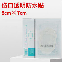 妥能医用留置针贴透明敷料贴导管固定贴置管敷贴膜输液敷料护脐贴 50片