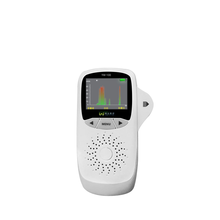 便携式肢体外周血管血流速度检测观察仪医用超声多普勒血流检测仪 无打印机