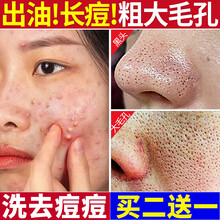 氨基酸洗面奶泡沫面部控油抗祛痘印痤疮痘痘男士女学生毛孔粗大除螨虫去黑头去角质死皮慕斯水杨酸洁面乳康雪 单瓶装（买2只可多送1只，三只一疗程）