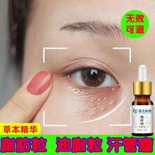 脂肪粒草本祛眼部脂肪粒油脂粒汗管瘤眼霜膏黑眼圈袋眼部细纹眼部护理精华液 三瓶周期装