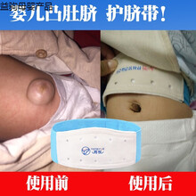 婴儿凸肚脐护脐带新生儿0-6个月宝宝肚脐突出透气绑脐带护肚围袋 _推荐_两条换洗装 6个肚脐包 适合5-20斤的婴儿 可调节
