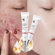 修正青春痘痘肌修护精华乳 改善痘痘痘肌修护祛痘膏痘坑痘疤淡化痘印祛痘凝胶粉刺青春痘男女皆可用 一支装