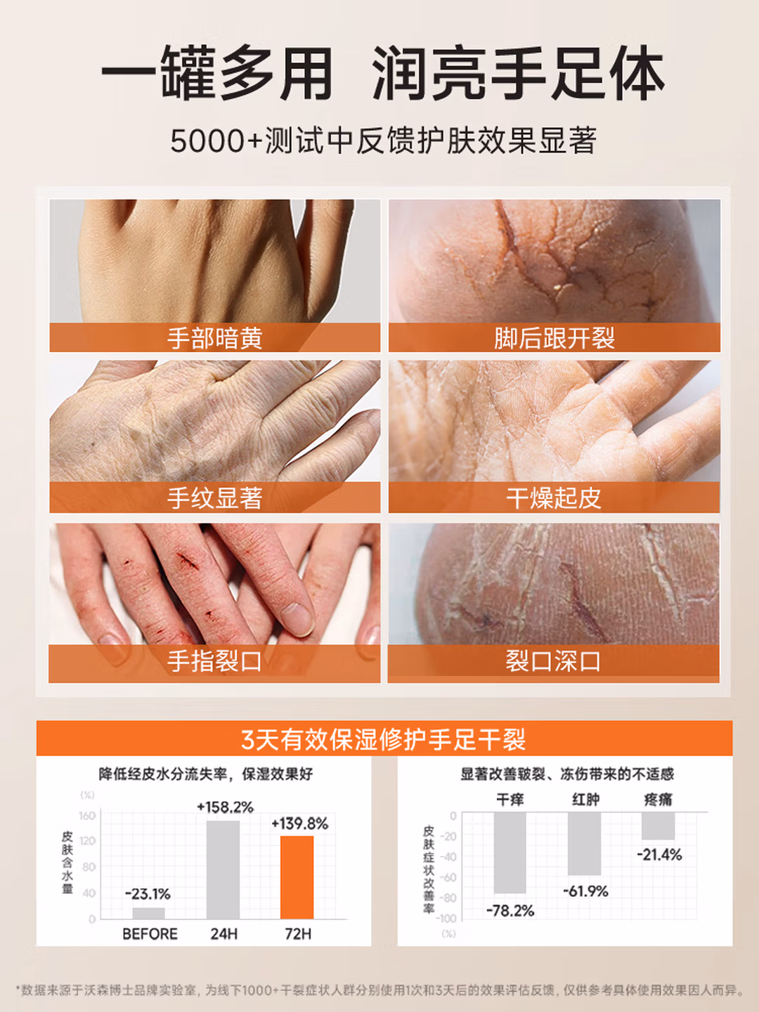 沃森博士马油护手霜手干燥粗糙防裂修复手足嫩肤保湿补水改善脱皮皲裂60g