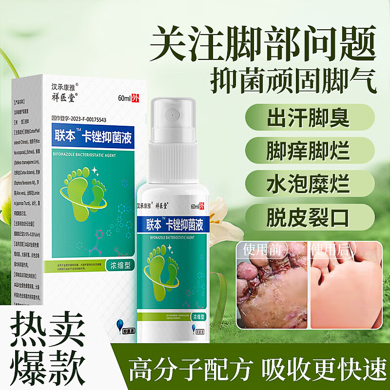 【16.9包邮】祥医堂 联本卡锉脚气抑菌液 60ml*2瓶