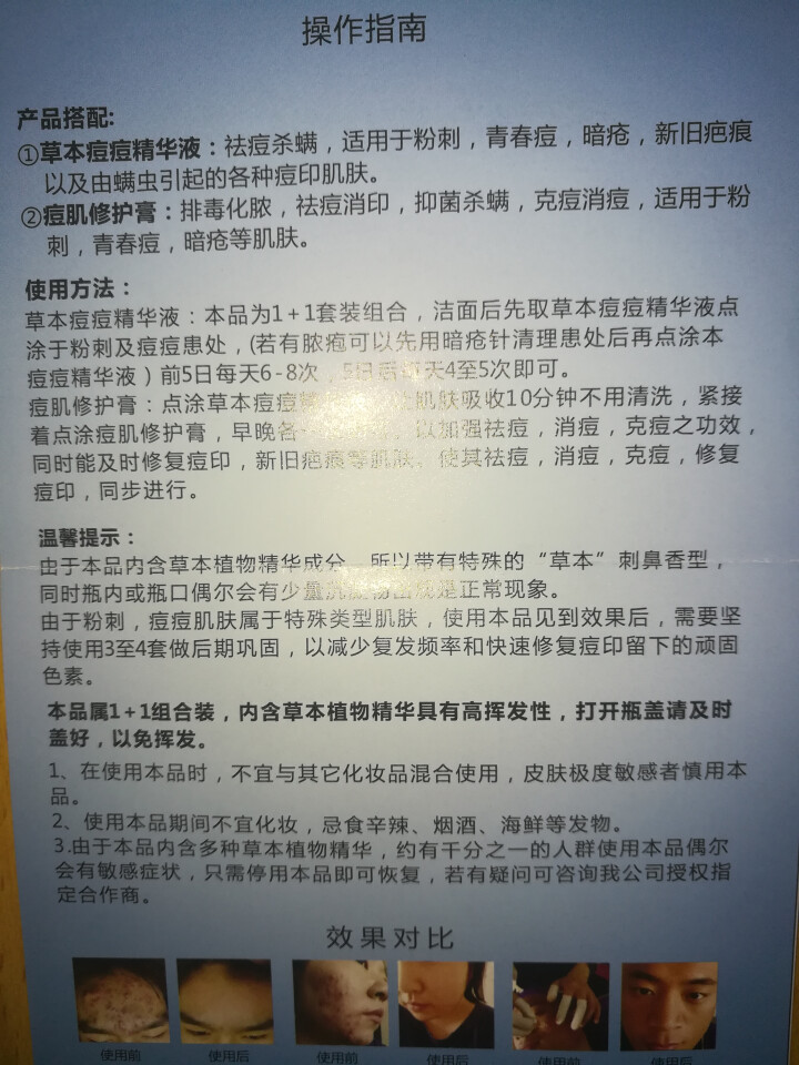 凝米祛痘精华痘印修护膏套装快速祛痘闭合性痘痘控油修护淡化痘印精华液男女通用怎么样，好用吗，口碑，心得，评价，试用报告,第4张